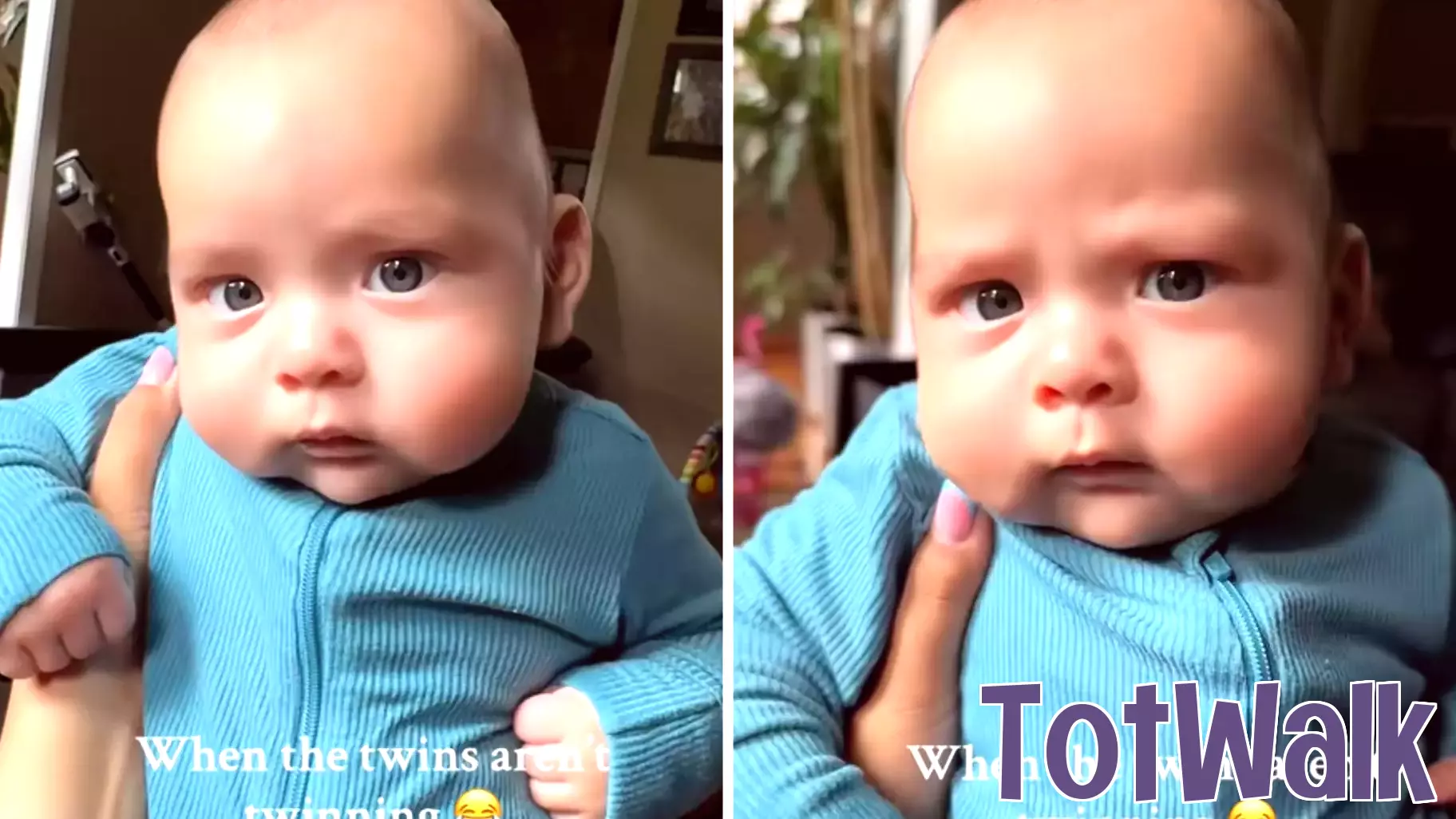 Surprising Transformation: Mom Discovers Twins' Unique Features Four Months After Birth