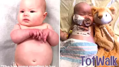 Parents Discover Heartbreaking Cause Behind Baby's Swollen Feet