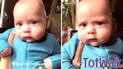Surprising Transformation: Mom Discovers Twins' Unique Features Four Months After Birth